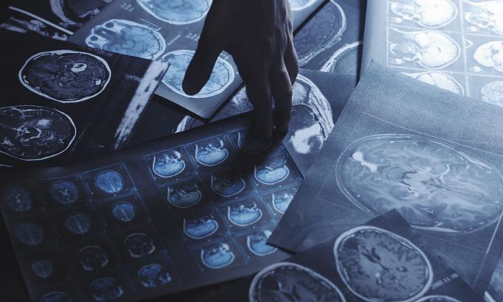 Аспирантка ОмГМУ получила грант в 2 миллиона рублей на онкологическое исследование