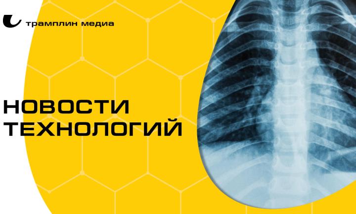 Безопасный рентген и роботы-манипуляторы. Топ разработок российских учёных
